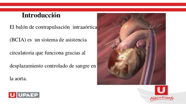 balon contrapulsacion